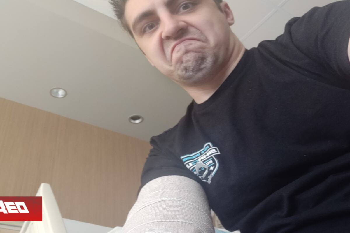 Shroud se aleja de los streams por accidente que involucró su codo